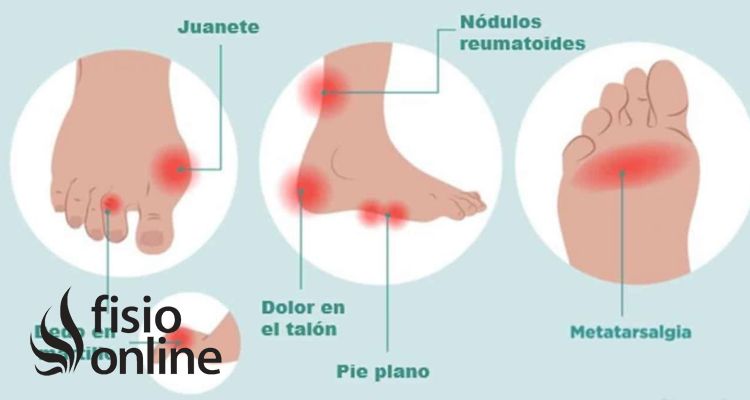 Los zapatos adecuados para aliviar el dolor de pies: una elección imprescindible