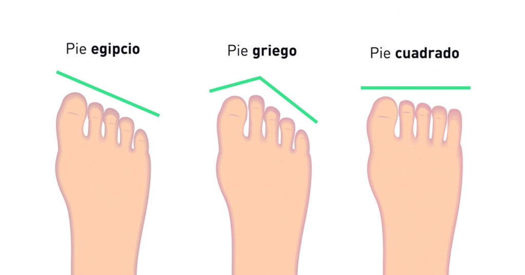 ¿Qué tipo de pie es el más común?