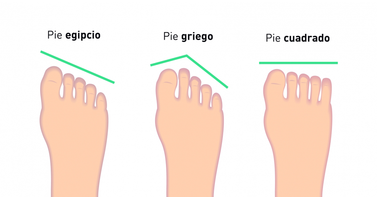 ¿Qué tipo de pie es el más común?